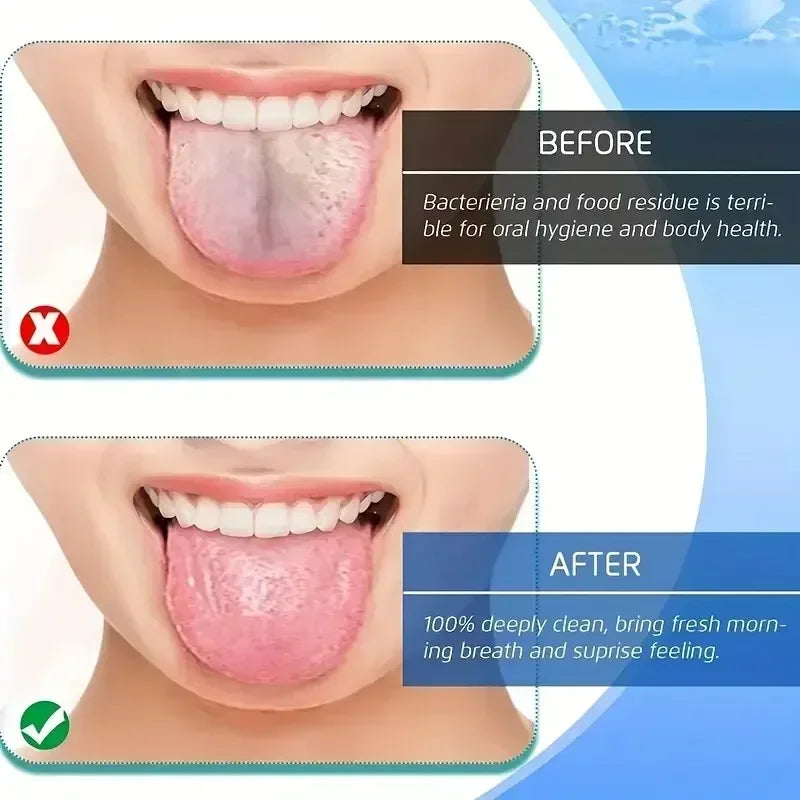 Stainless Steel Tongue Scraper, U-shaped Metal Tongue Cleaner 3 Colors, Fresh Breath Oral Hygiene Care Tool