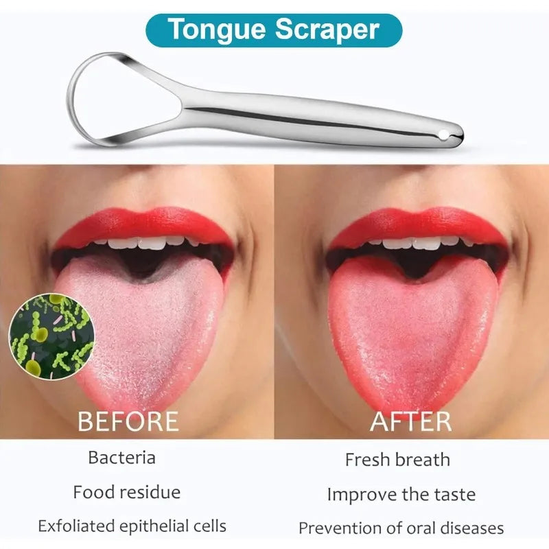 Stainless Steel Tongue Cleaner